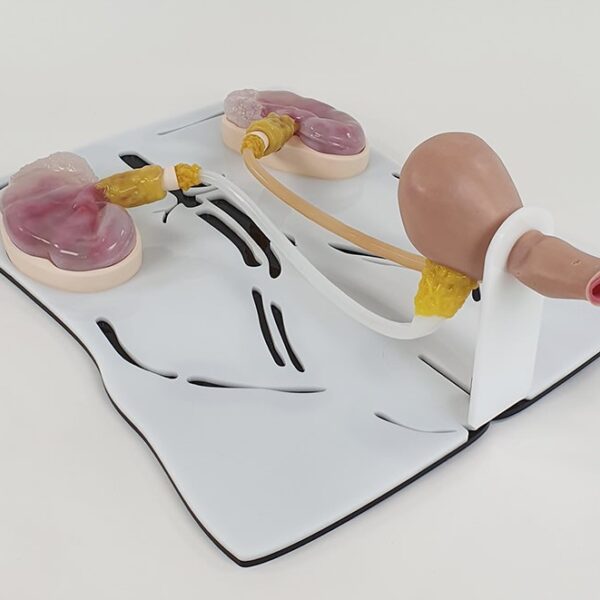 Colon Polypectomy Trainer