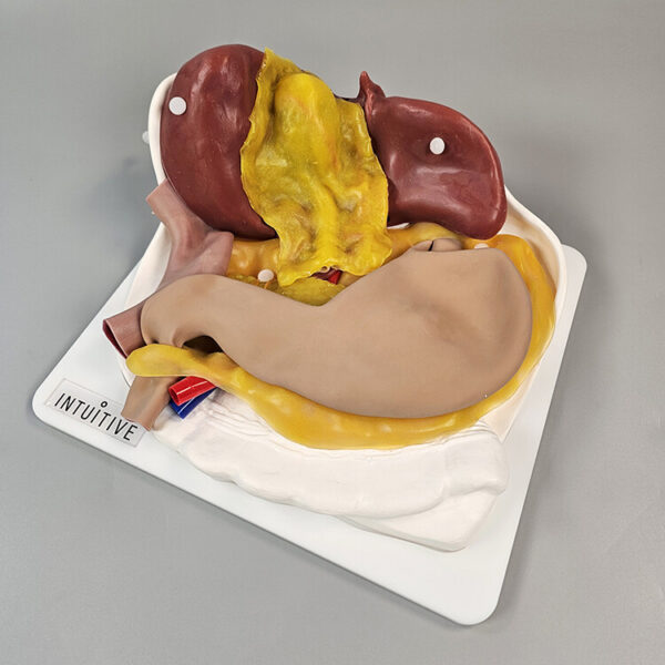 Gastric Vascular Dissection Trainer