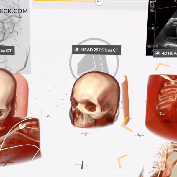 Medical imaging XR 1