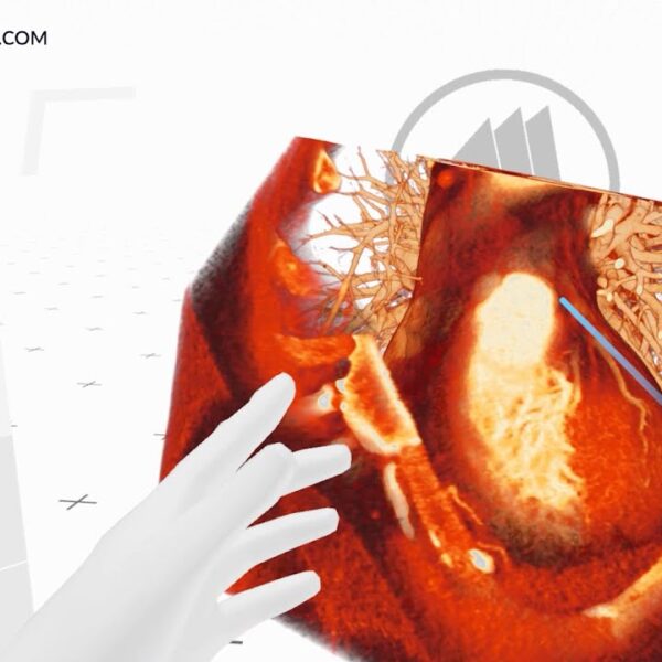 Medical imaging XR 2