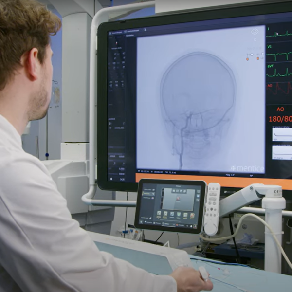 Procedural Intelligence