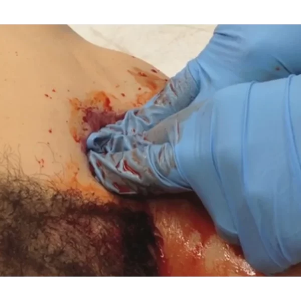 inguinal-crease-wound-packing-web_1_bcdb8d8e-8784-4967-8266-177735dafb25_2048x2048